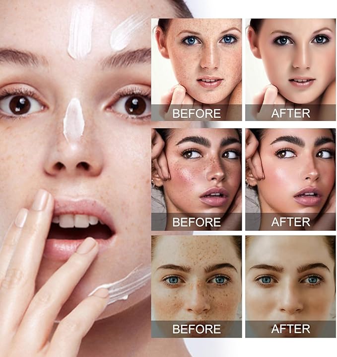 Facial cream being applied, with multi-panel before and after skin results