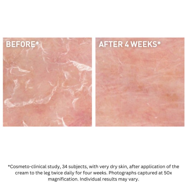 Moisturizing cream skin results showing before and after 4 weeks