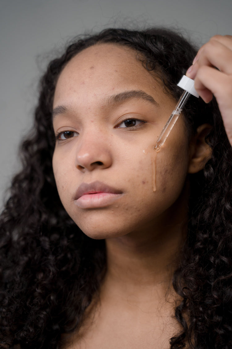 Dark Spots