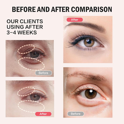 Retinol eye balm before-and-after comparison on model eyes