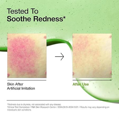 Anua 10+ serum bottle beside redness test panels, green glass and silver cap