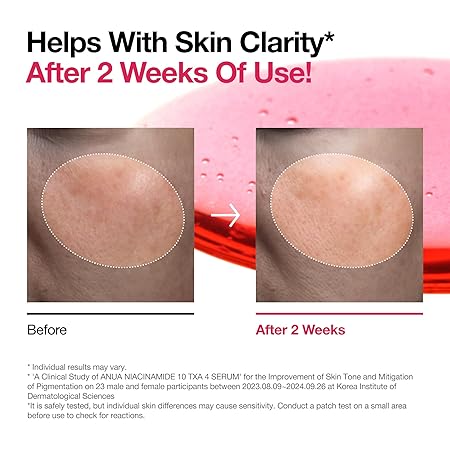 Before and after skin clarity on cheeks after using serum
