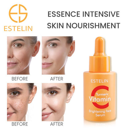 ESTELIN turmeric vitamin face serum bottle with before/after face photos