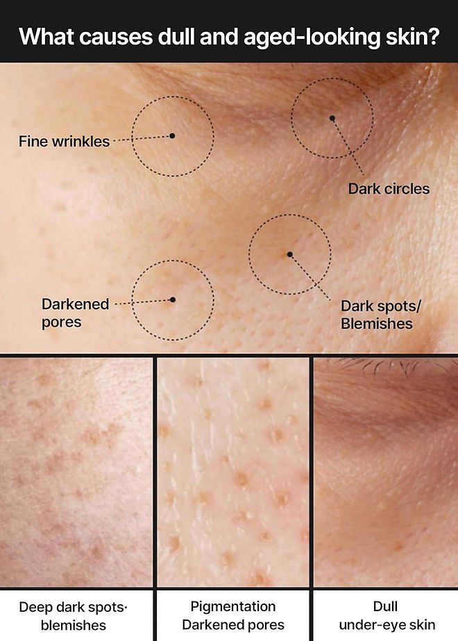 Dull-skin face cream infographic showing dark spots, pigmentation, and uneven skin