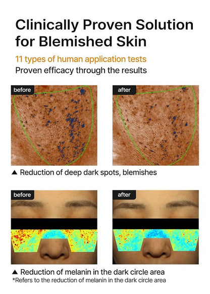 Blemished-skin face cream infographic with reduction charts and before-and-after panels