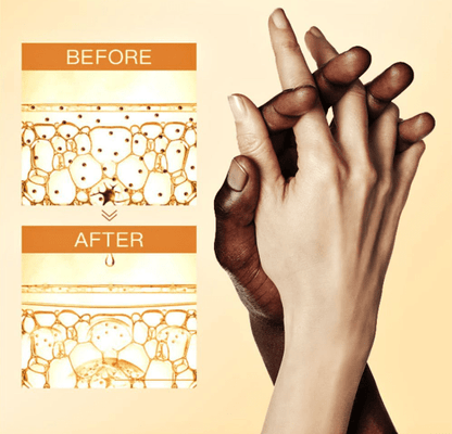 Whitening cream effect on hands, showing darker knuckles and improved after