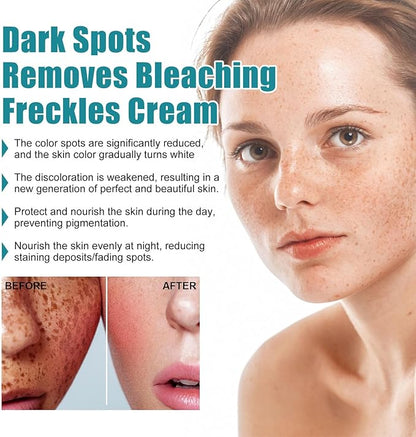 Woman’s face with visible freckles, dark spot removal before and after