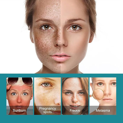 Woman’s face with freckled dark spots and uneven skin tone