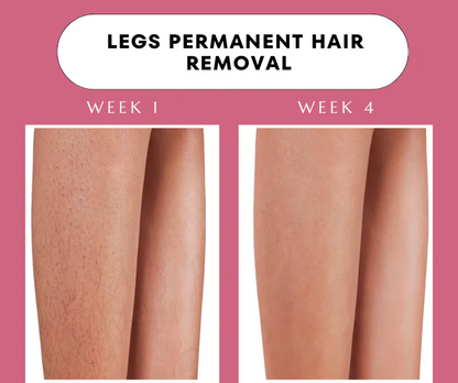 Nasal inhaler before-and-after leg hair comparison, week 1 to week 4