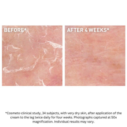 Moisturizing cream skin results showing before and after 4 weeks