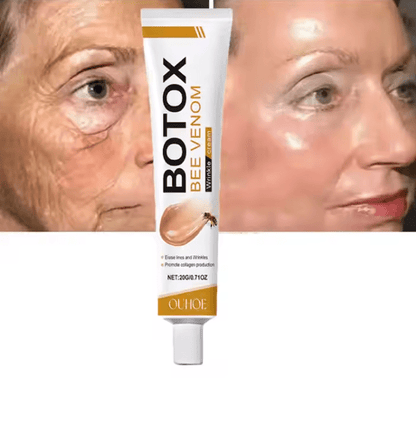 Bee venom wrinkle cream tube with front label, shown beside face before/after