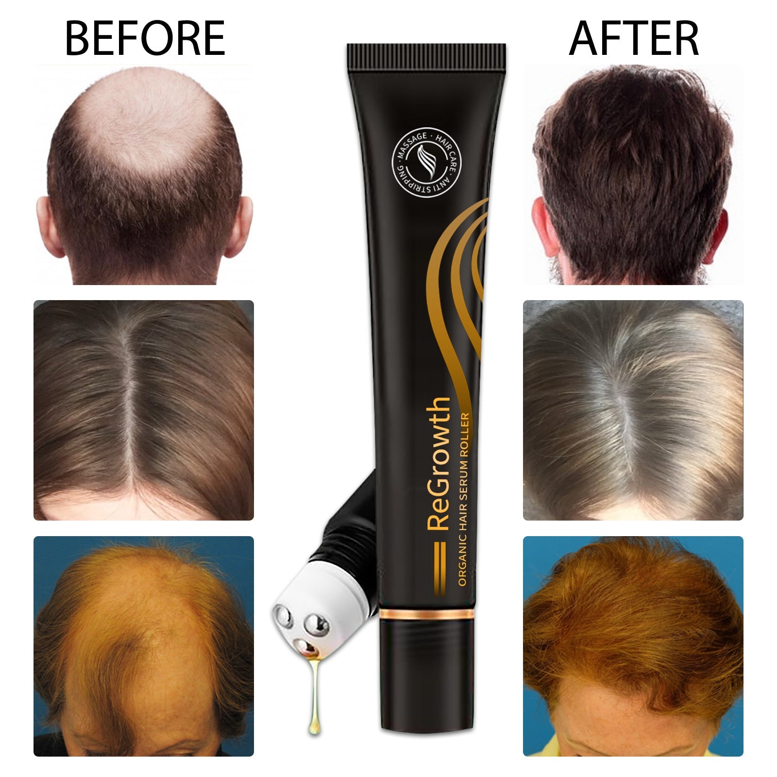 Hair growth serum tube with gold label and roller applicator over scalp images