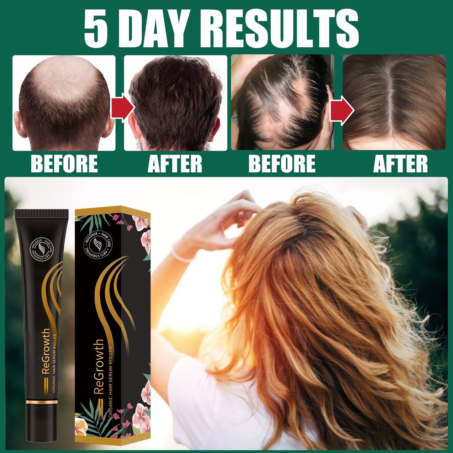 Hair growth serum tube and floral box next to before-and-after scalp results