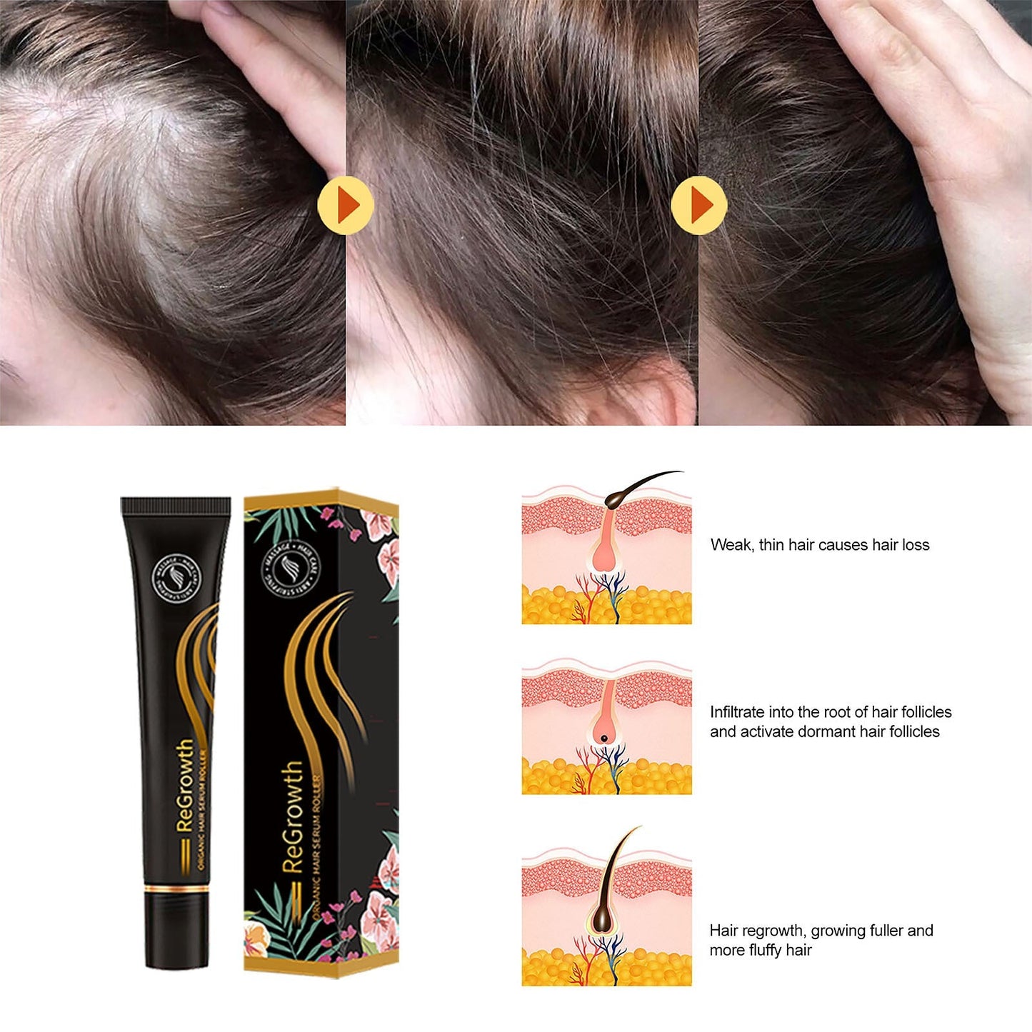 Hair growth serum on scalp close-ups, with product tube and floral box