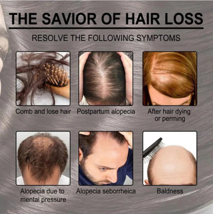 Rosemary essential oil infographic showing hair loss and alopecia examples
