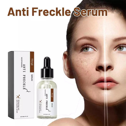 Anti-freckle face serum bottle with black dropper and white box