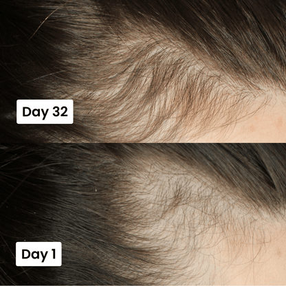 Close-up of scalp and hair roots, Day 32 and Day 1 comparison