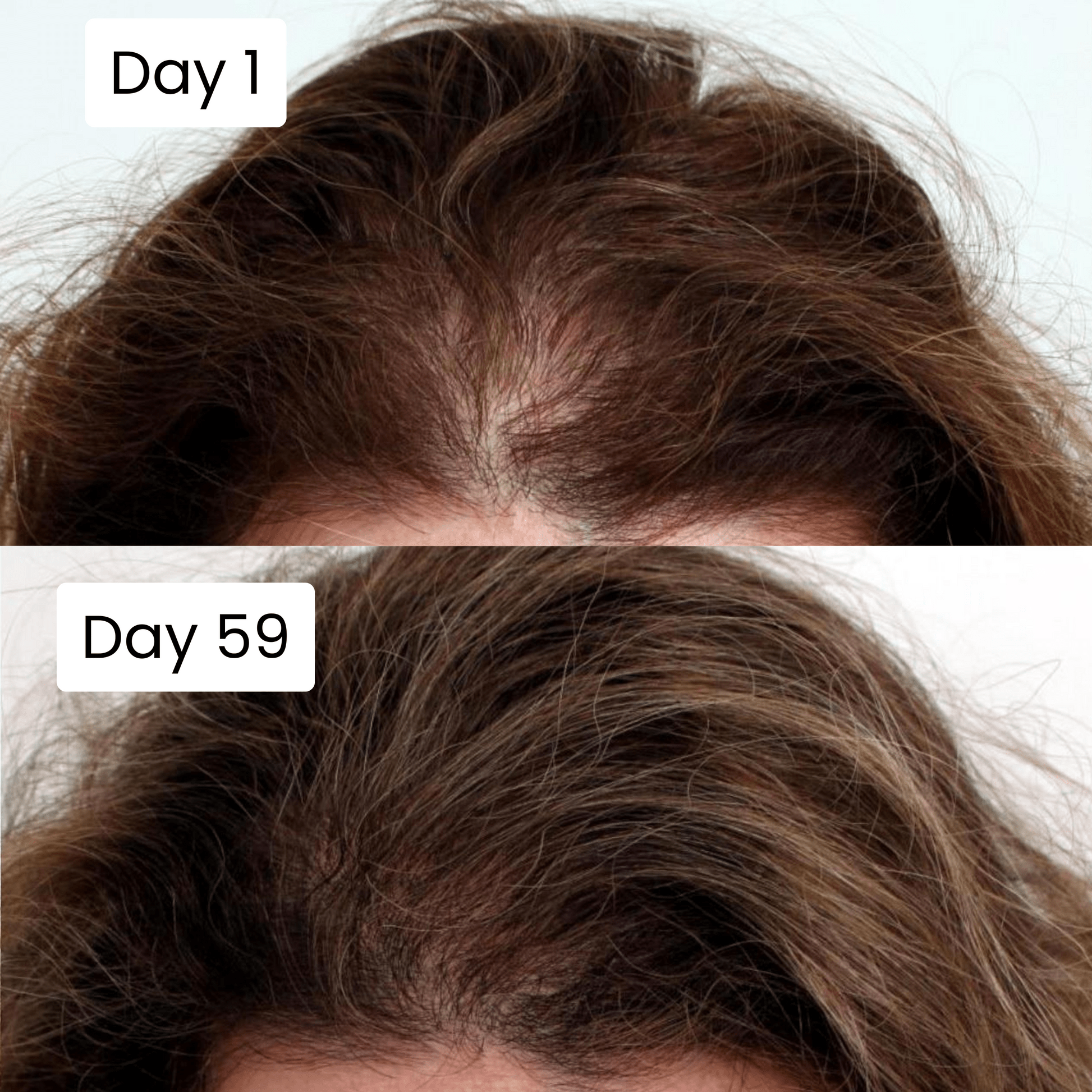 Top-of-head scalp with hair strands, Day 1 and Day 59 side-by-side