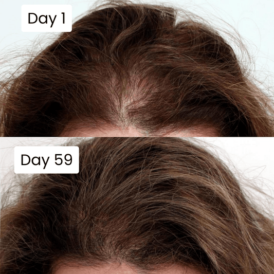 Top-of-head scalp with hair strands, Day 1 and Day 59 side-by-side