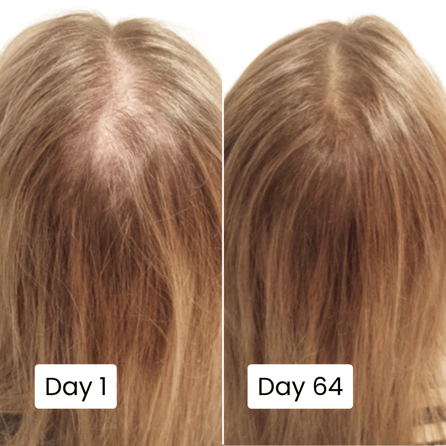 Crown scalp split view showing hair coverage for Day 1 and Day 64