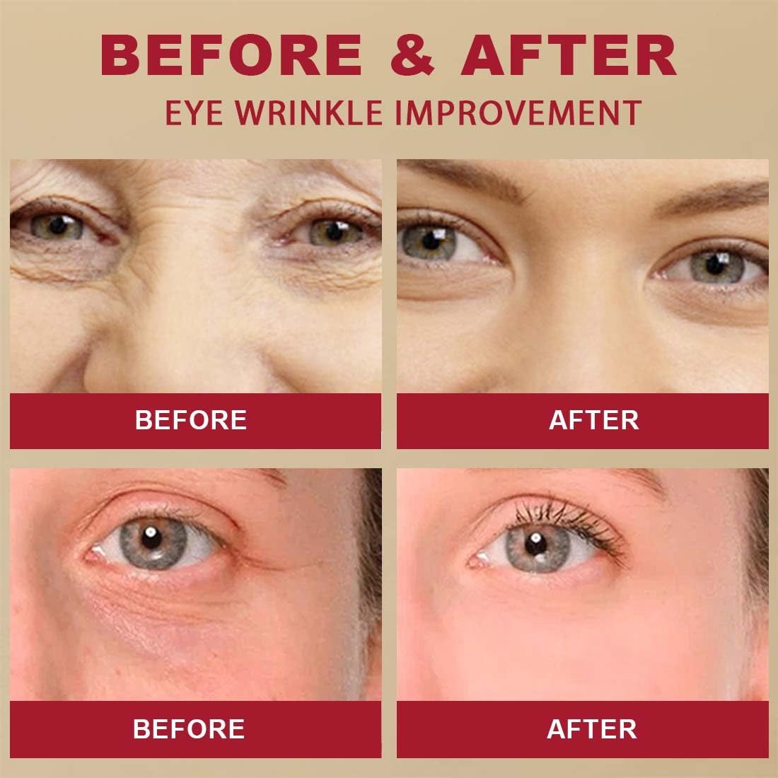 Four-panel close-up of eye area showing before and after skin improvement