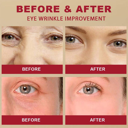 Four-panel close-up of eye area showing before and after skin improvement
