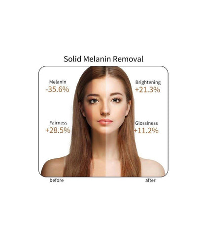 Skincare before-and-after comparison with model face and effect callouts