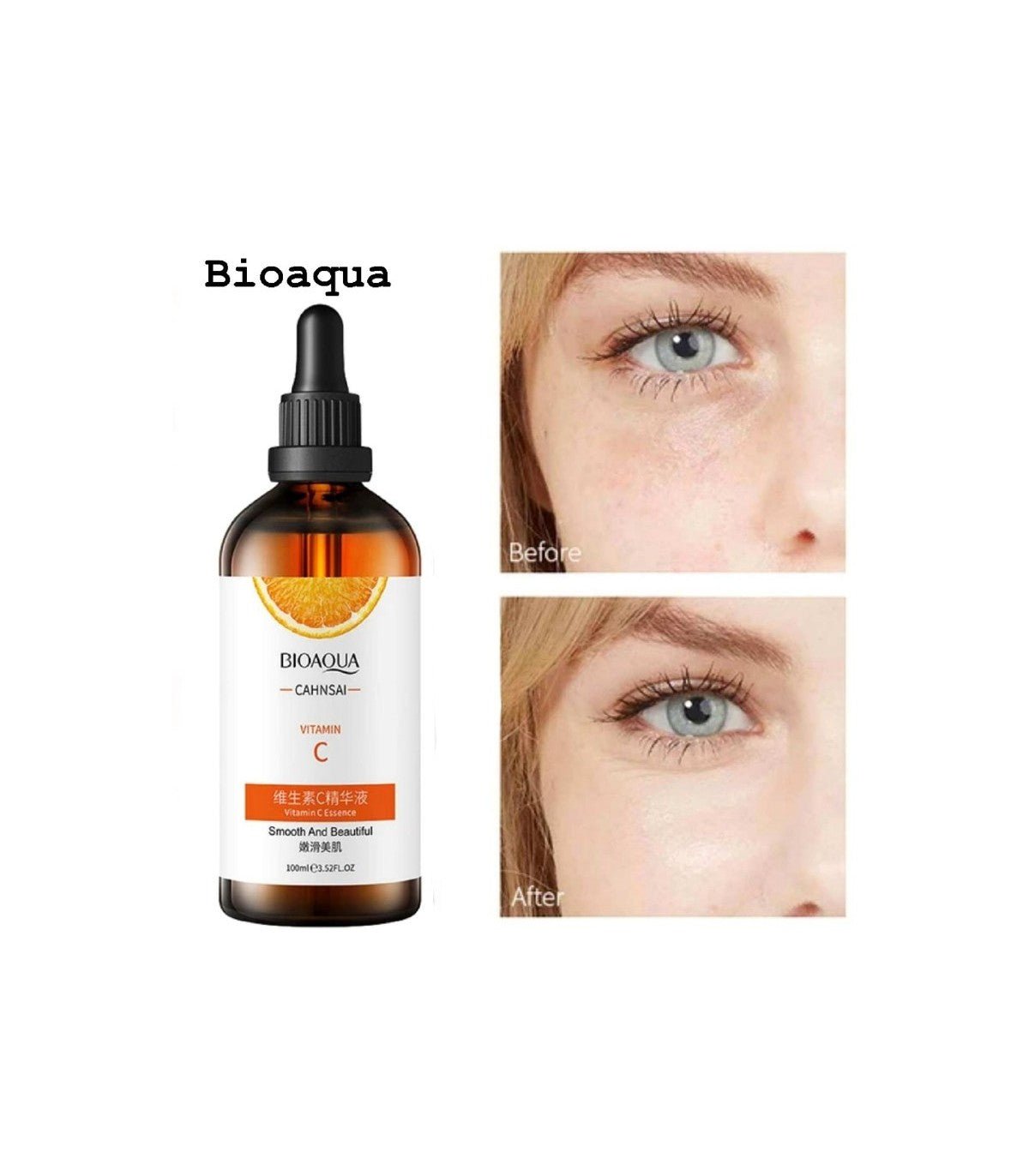 Vitamin C serum bottle with before-and-after close-up of eye area