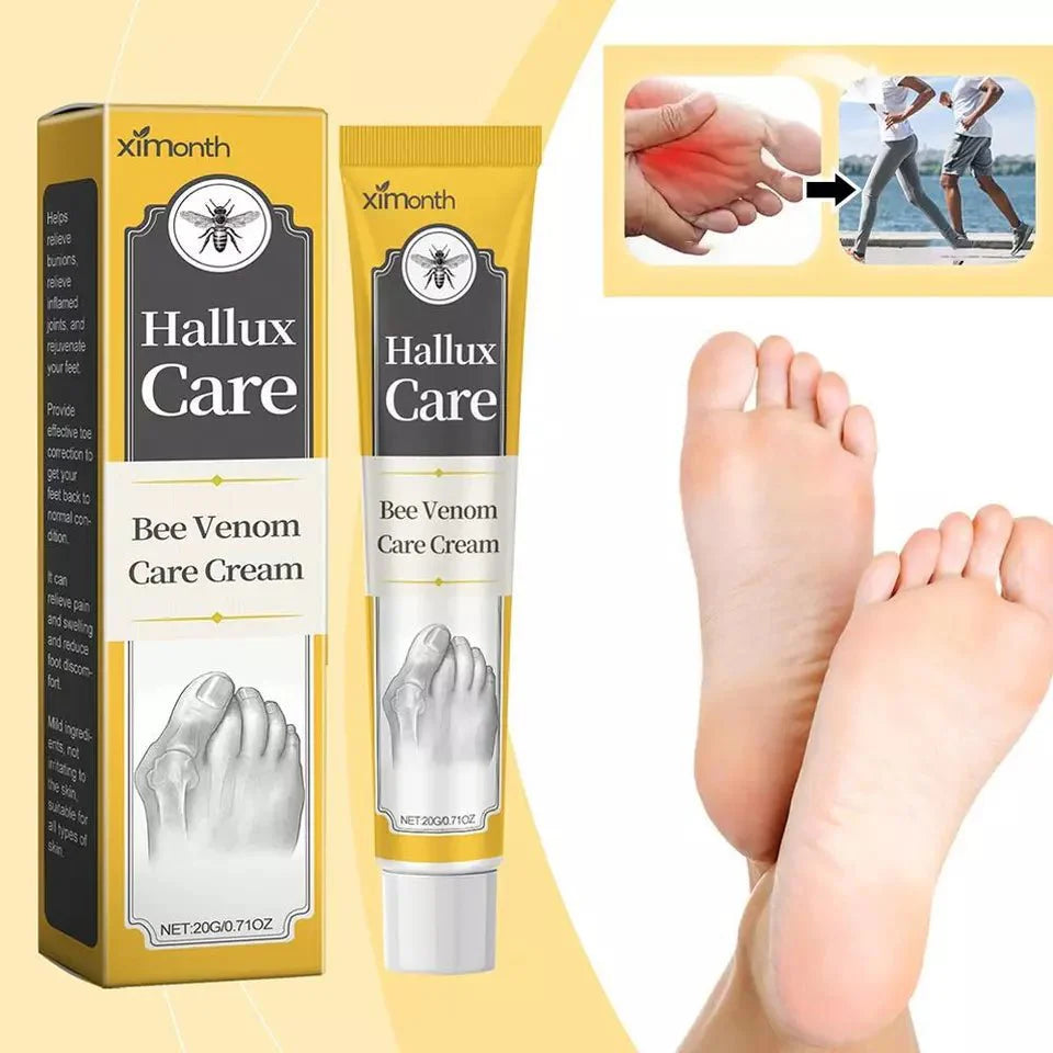 Ximonth Hallux Care bee venom care cream box and tube beside two bare feet